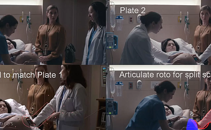 Cadence Effects制作的《双胞胎(Dead Ringers)》-视效解析